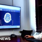 AI Collaborates with Medical Professionals to Enhance Diagnostic Accuracy